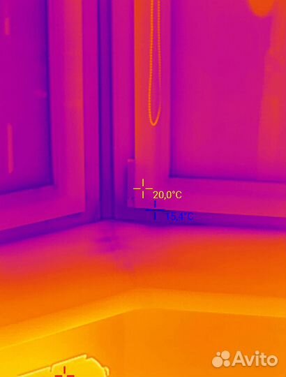 Обследование тепловизором