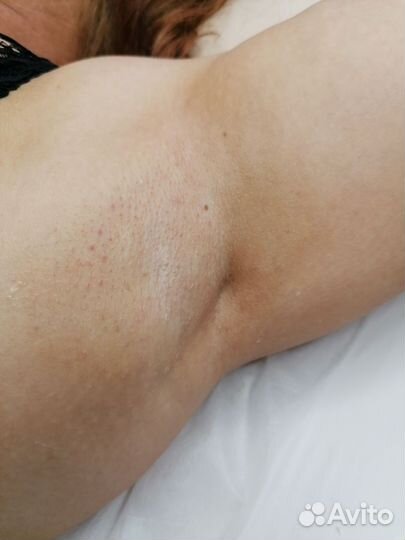 Эпиляция воском