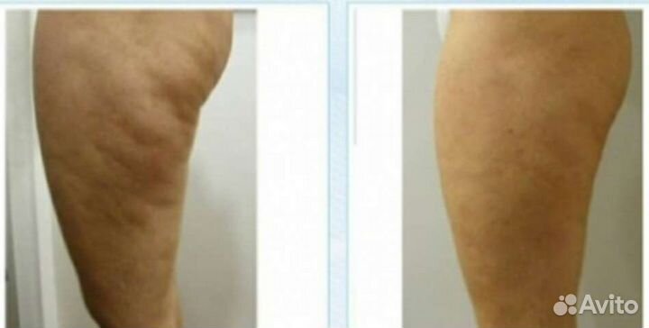 Массаж.Косметология.Чистое Небо