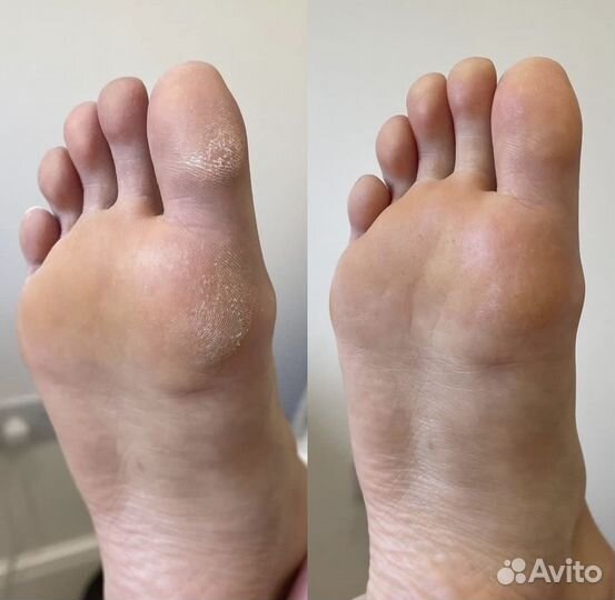 Маникюр Педикюр любой сложности