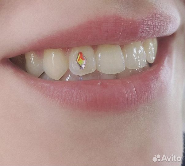 Установка Скайс