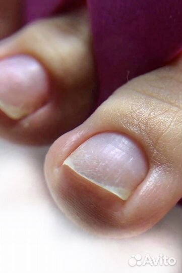 Подология и эстетика