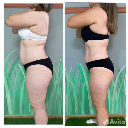 Обучение аппаратный массаж. Выдача Сертификатов