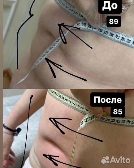 Минус 3-4 см за комплекс гарантированно