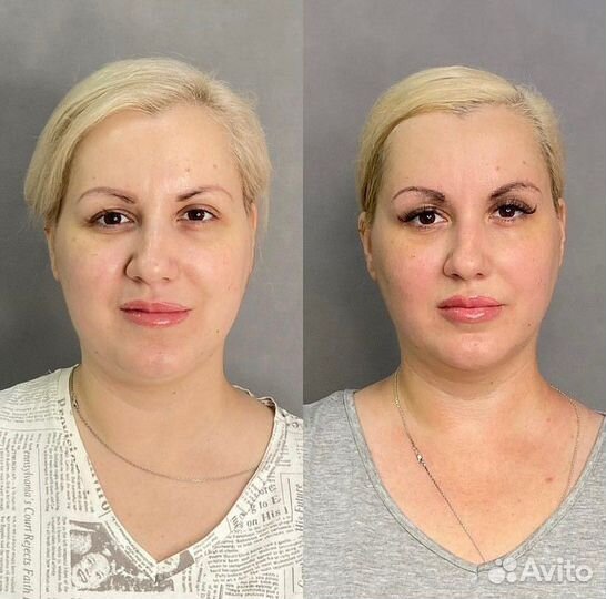 Липолитики, худое лицо, худое тело