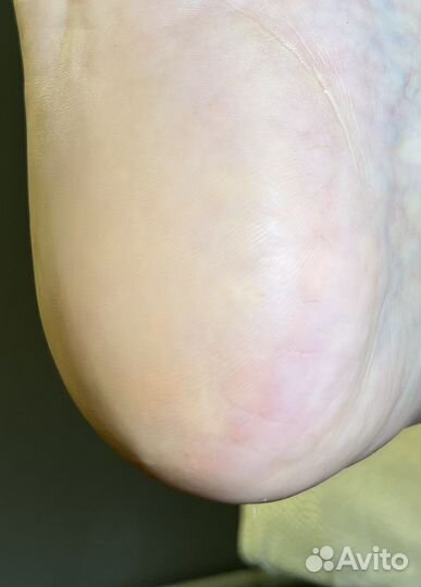 Модель на педикюр / Бесплатно