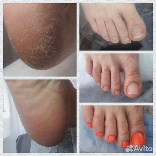 Маникюр и педикюр