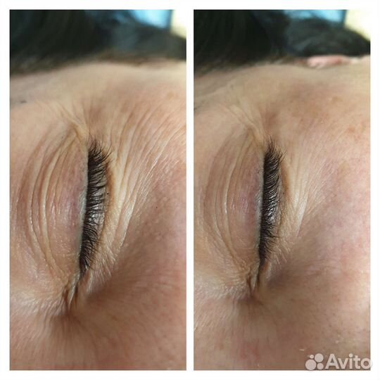 Скульптурный массаж лица