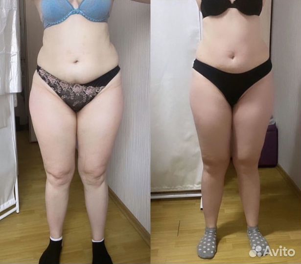 Массаж уз кавитация