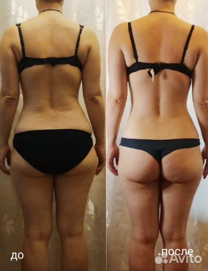 Эстетическая коррекция тела. Не массаж