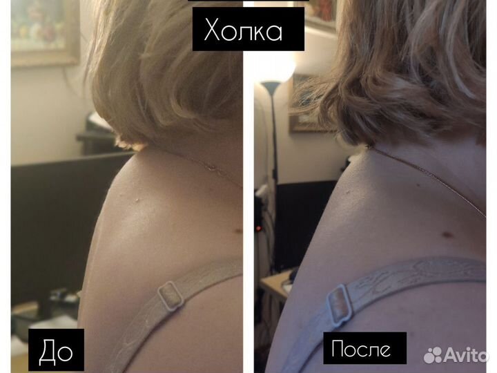 Оздоровление