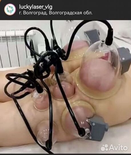 Коррекция фигуры, аппаратные процедуры