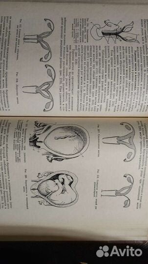 Учебник акушерство