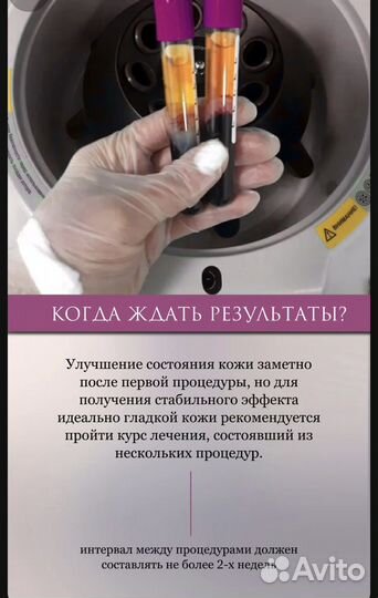 Плазмотерапия, плазмолифтинг, PRP
