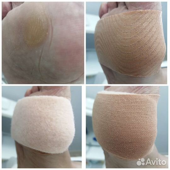 Аппаратный, Медицинский педикюр (Подолог)