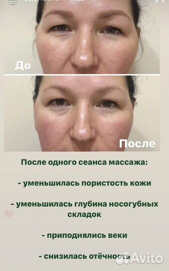 Массаж лица Кобидо, буккальный, гуаша, миофасц-й