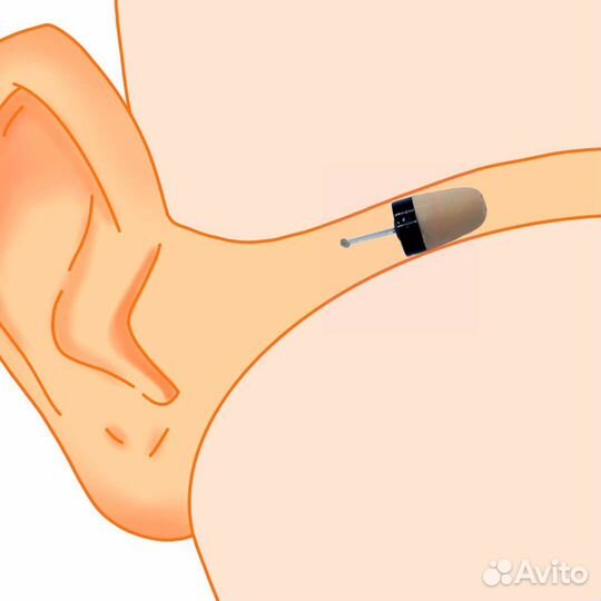 Микронаушники Купить / Аренда