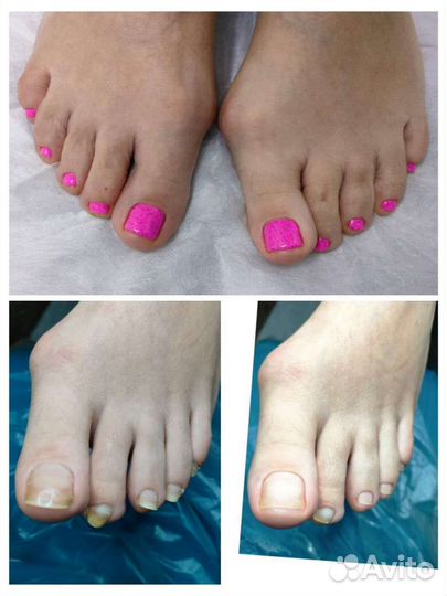 Наращивание ногтей