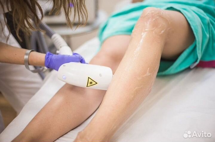 Готовый бизнес лазерной эпиляции под ключ