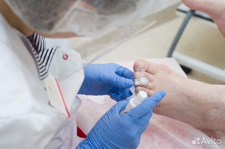 Лечебный педикюр, грибок ногтей