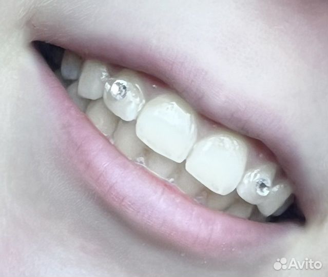 Установка скайсов