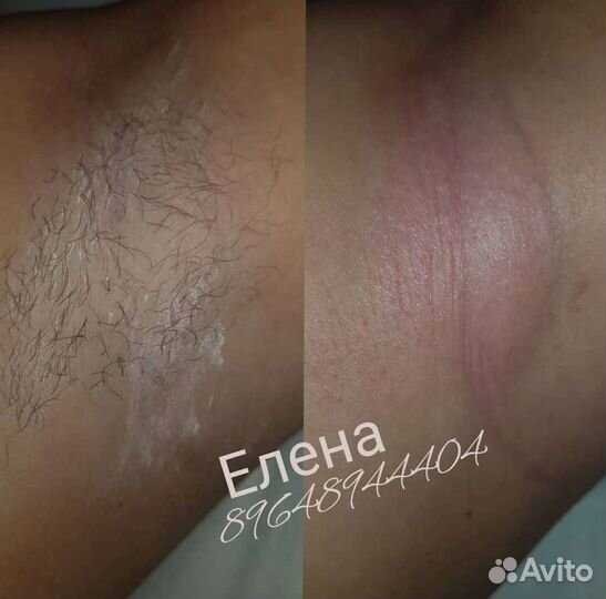 Красота