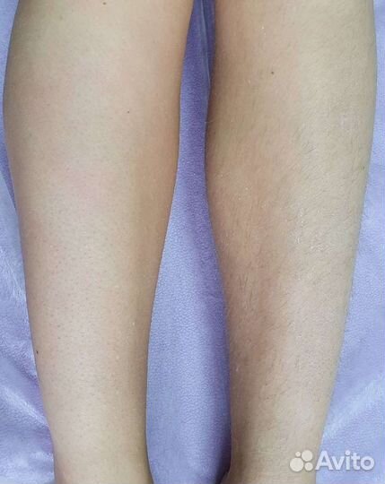 Шугаринг Женский