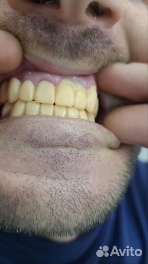 Зубной техник