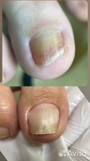 Подолог. Маникюр педикюр