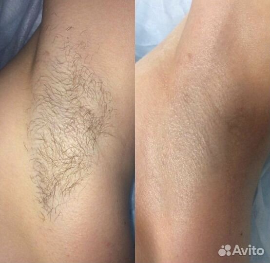 Массаж лица/ депиляция