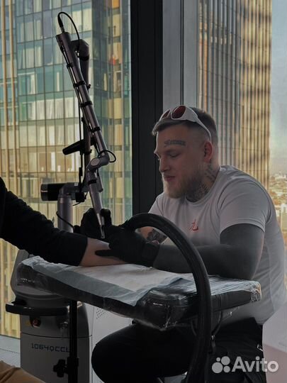 Лазерное удаление татуировок / удаление тату