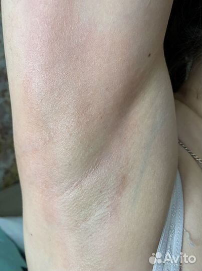 Шугаринг на дому