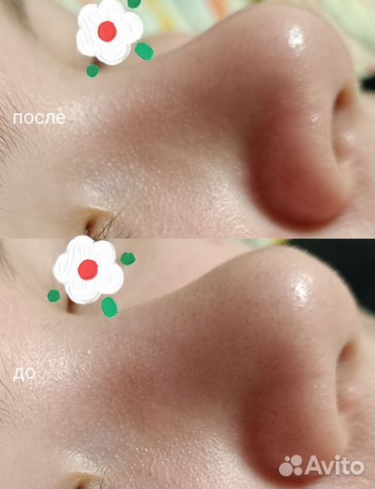 Услуги косметолога - эстетиста, массаж