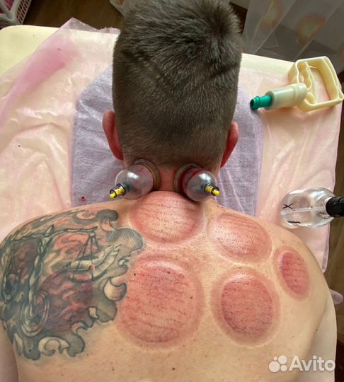 Услуги массажиста