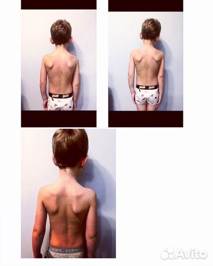 Детский массаж\лфк\консультация