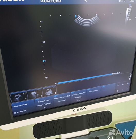 Узи аппарат Chison