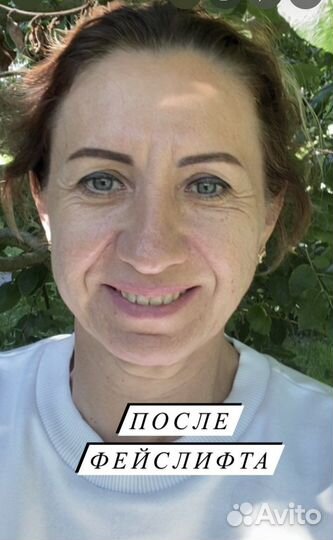 Access Бары - Фейслифтинг