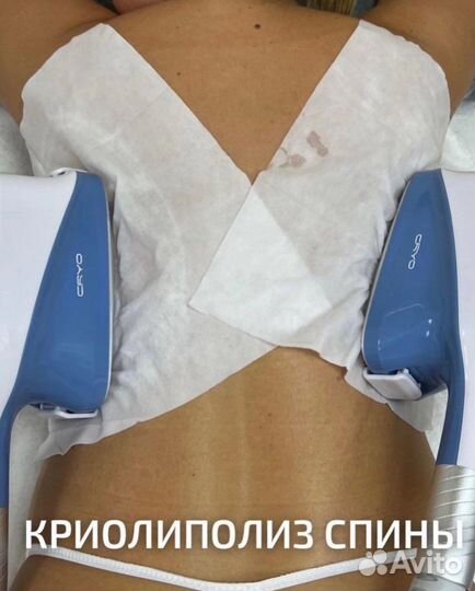 Криолиполиз RF лифтинг Кавитация Миостимуляция