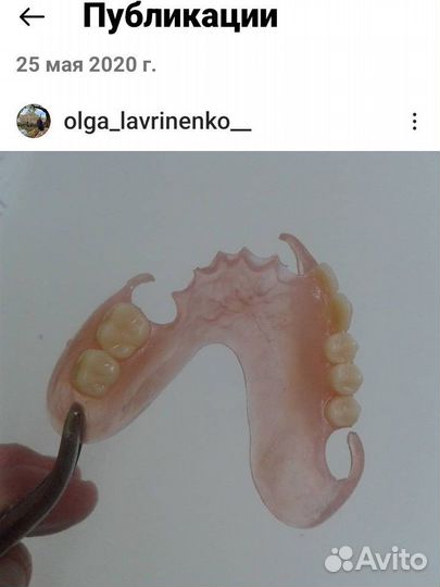 Услуги зубного техника