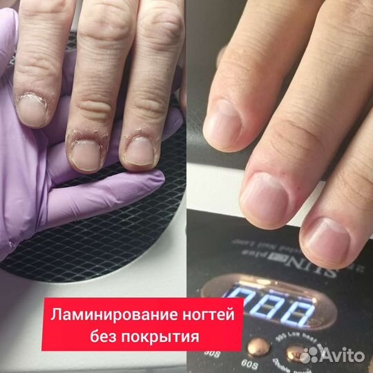 Педикюр на дому