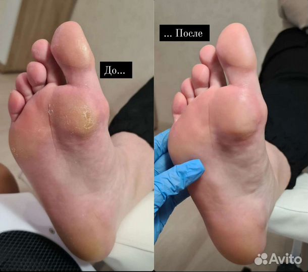 Маникюр, покрытие гель-лак, наращивание, педикюр