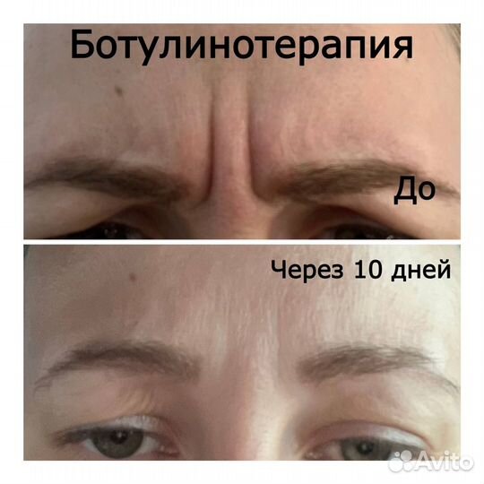 Косметолог чистка лица