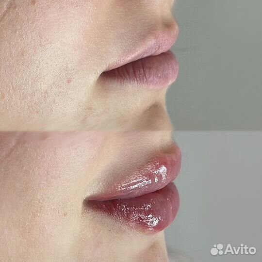 Косметолог. Губы