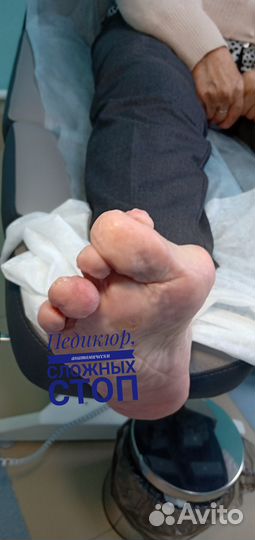 Подолог, педикюр