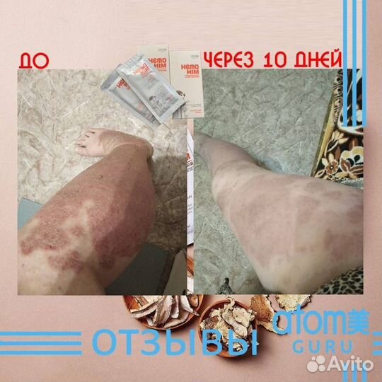 HemoHim иммунитет