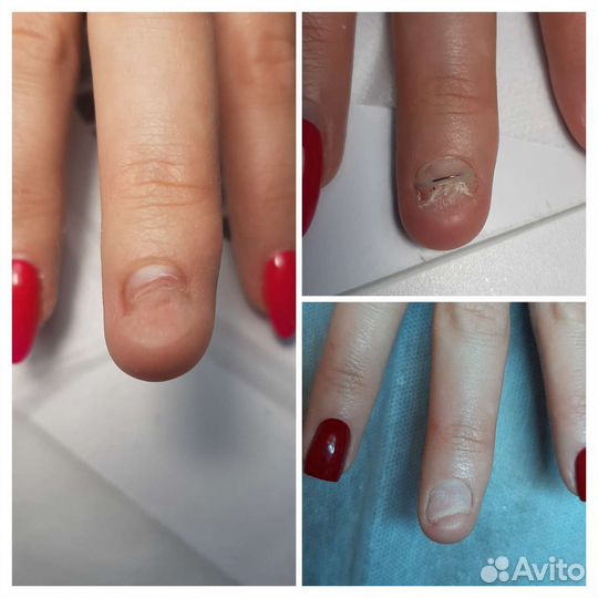 Подолог(химки,куркино,новогорск),подолог(выезд)