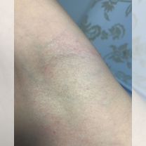 Электроэпиляция, метро Аэропорт, салон Бьянка Люкс, Москва