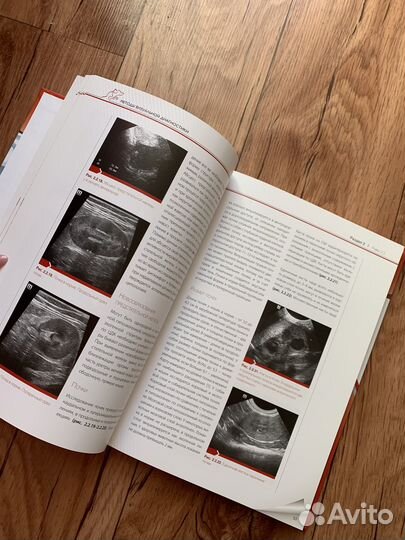 Руководство по оперативной урологии мдж. А.Лапшин