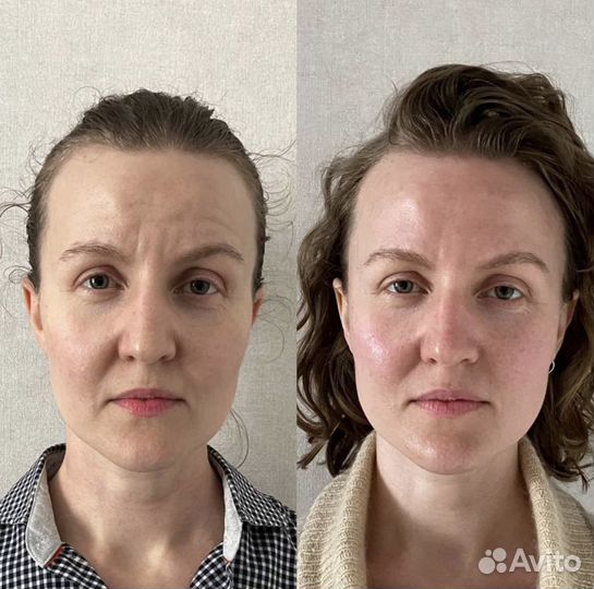 Миофасциальный массаж+Буккальный массаж