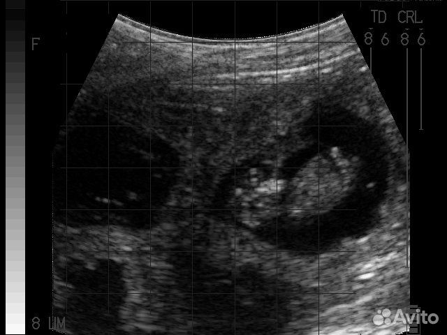 Узи диагностика козы/овцы